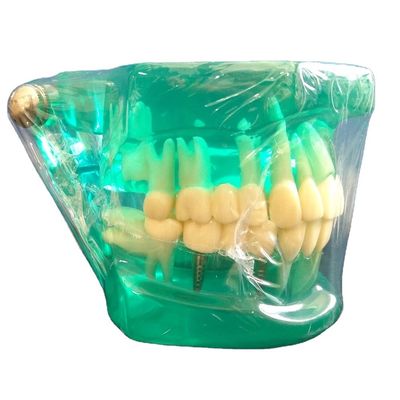 DTC ortodontica dentale tipiodonte supporti modello personalizzato per manuale e OEM