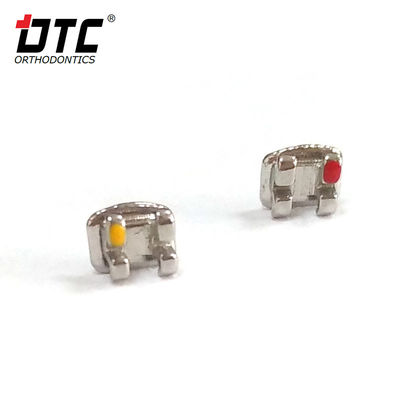 Le staffe in metallo della serie DTC Bright sono la chiave per un trattamento ortodontico di classe II di successo