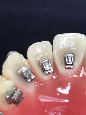 Clinica tubi molari supporti dentali per la lingua per DTC ortodonzia supporto autoligante