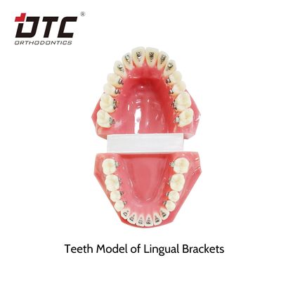 Le apparecchiature ortodontiche per la lingua DTC standard CE per il trattamento ortodontico a dimensioni ridotte