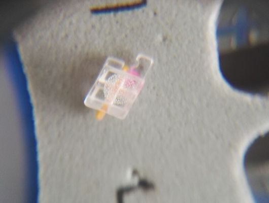 Trattamento ortodontico con DTC Sapphire Bracket Dental Brace Standard ISO