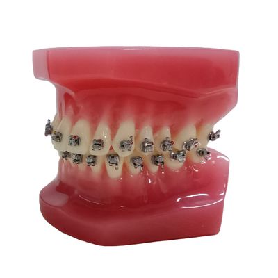 DTC ortodontica dentale tipiodonte supporti modello personalizzato per manuale e OEM